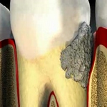 Что такое терапевтическая стоматология? [category]