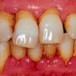 Что такое терапевтическая стоматология? [category]