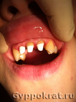 Результаты работ нашей стоматологии