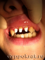 Результаты работ нашей стоматологии