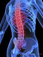 Лечение боли в спине, пояснице и позвоночнике