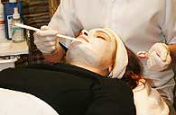 Лечение купероза на лице